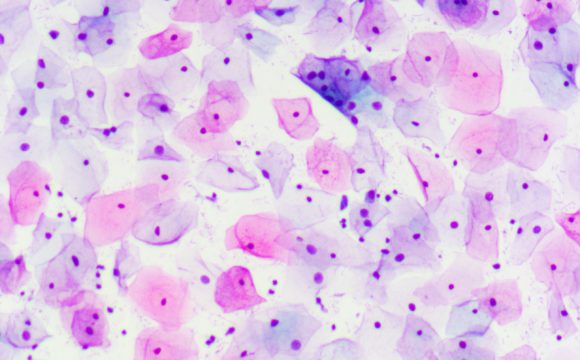 Cytology